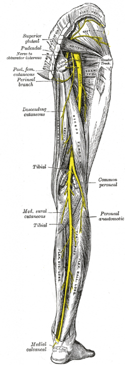 Piriformis Syndrome diagram down leg